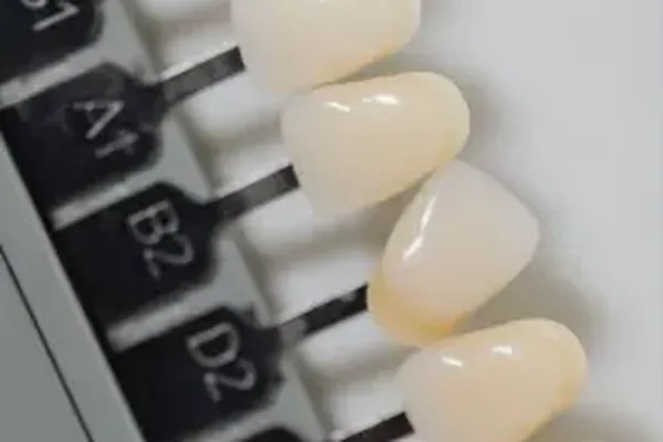 Coronas de Zirconia