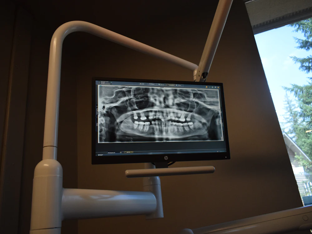 Una radiografía dental en un monitor en una clínica